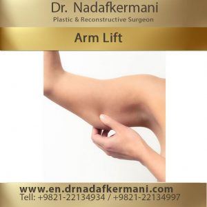 arm lift