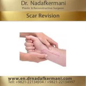 scar revision