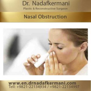 nasal obstruction after rhinoplasty